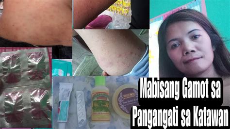 mabisang gamot sa pangangati ng pepe|12 rason kung bakit makati ang pwerta ng babae.